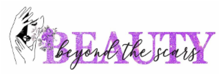 BEAUTY BEYOND THE SCARS logo