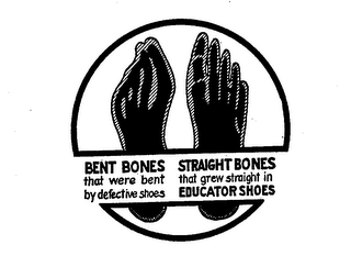 BENT BONES THAT WERE BENT BY DEFECTIVE SHOES STRAIGHT BONES THAT GREW STRAIGHT IN EDUCATOR SHOES logo