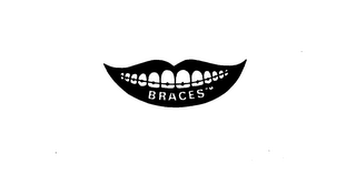 BRACES logo