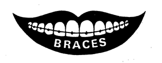 BRACES logo