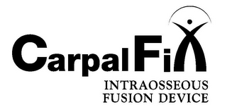 CARPALFIX INTRAOSSEOUS FUSION DEVICE logo