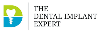 D THE DENTAL IMPLANT EXPERT logo