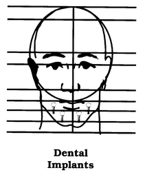 DENTAL IMPLANTS logo