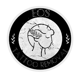 EOS TATTOO REMOVAL logo