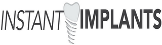 INSTANT IMPLANTS logo