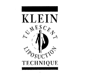 KLEIN TUMESCENT LIPOSUCTION TECHNIQUE