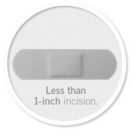 LESS THAN 1-INCH INCISION