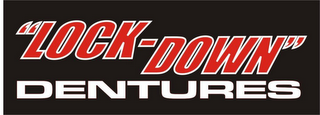 LOCK-DOWN DENTURES logo