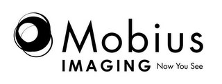 MOBIUS IMAGING NOW YOU SEE logo