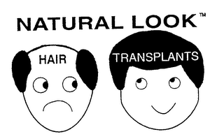 NATURAL LOOK HAIR TRANSPLANTS logo