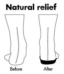 NATURAL RELIEF BEFORE AFTER logo