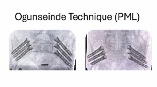 OGUNSEINDE TECHNIQUE (PML) logo