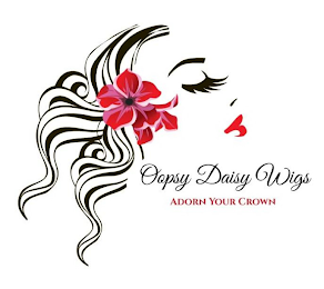 OOPSY DAISY WIGS ADORN YOUR CROWN logo