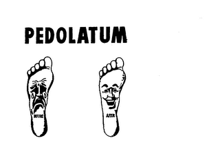 PEDOLATUM BEFORE AFTER logo