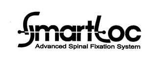 SMARTLOC ADVANCED SPINAL FIXATION SYSTEM logo