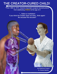 THE CREATOR-CURED CHILD! FROM 1965 TO 1974, MASSIVE TRAUMATIC-SURGICAL RECONSTRUCTIONS FROM SWALLOWING DRANO AT THE AGE OF 2 "... FICTION OR NONFICTION! IF YOU THINK THE CREATOR DOES NOT EXIST, THINK AGAIN! NO EXCUSES! NO EXCUSES!" (APEX) HALF OF A TONGUE THROAT REPLACEMENT (COLONIC INTERPOSITION) ABDOMINAL BOWELS RECONSTRUCTION MY PEDIATRICIAN SURGEON DR. ROWENA SPENCER logo