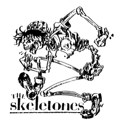 THE SKELETONES