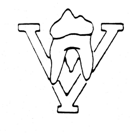 V logo