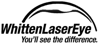 WHITTENLASEREYE YOU'LL SEE THE DIFFERENCE logo